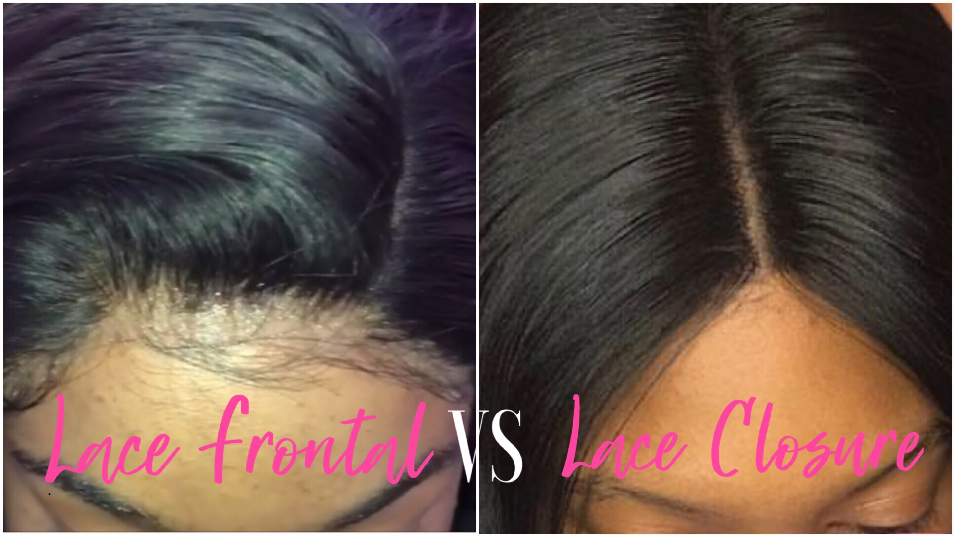 lace frontal and lace closure